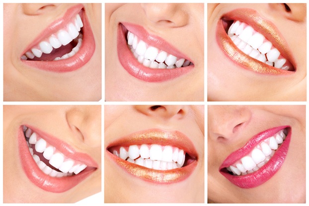 Orthodontic Treatment In Lodhi Colony